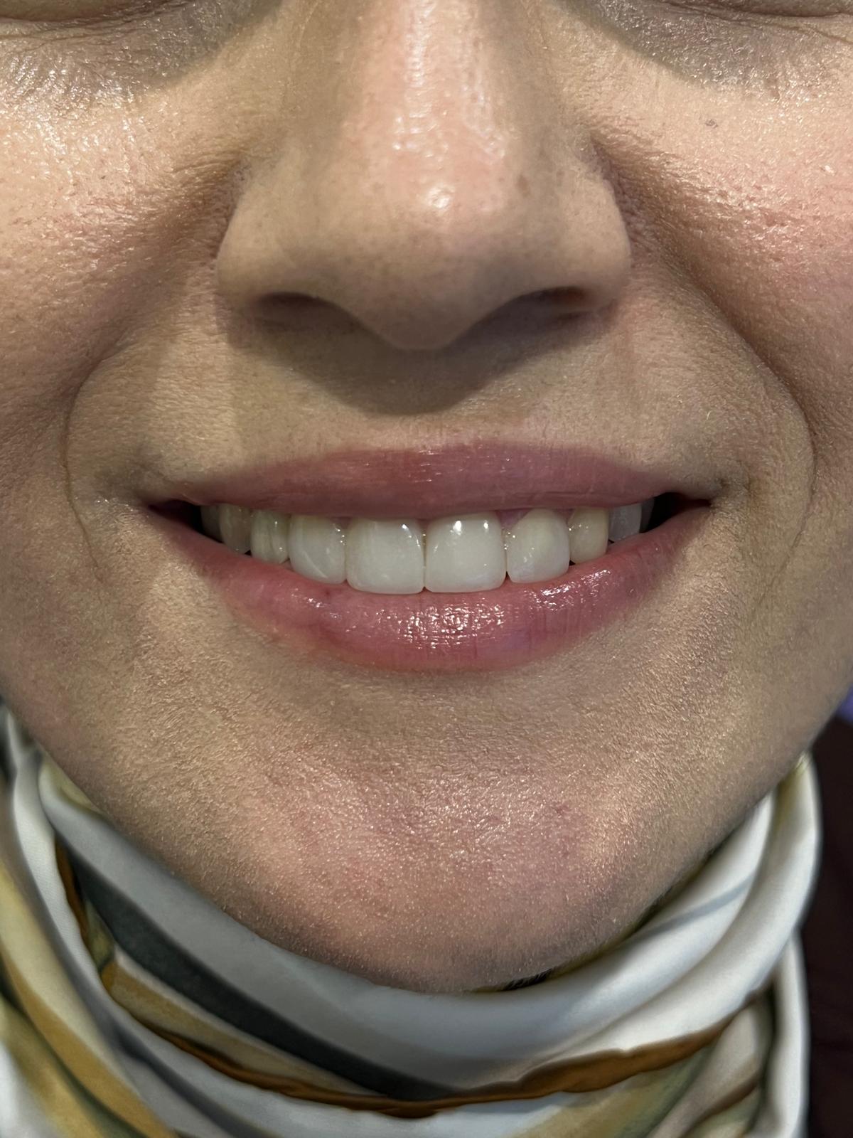 ECE Dental Patient Transformation